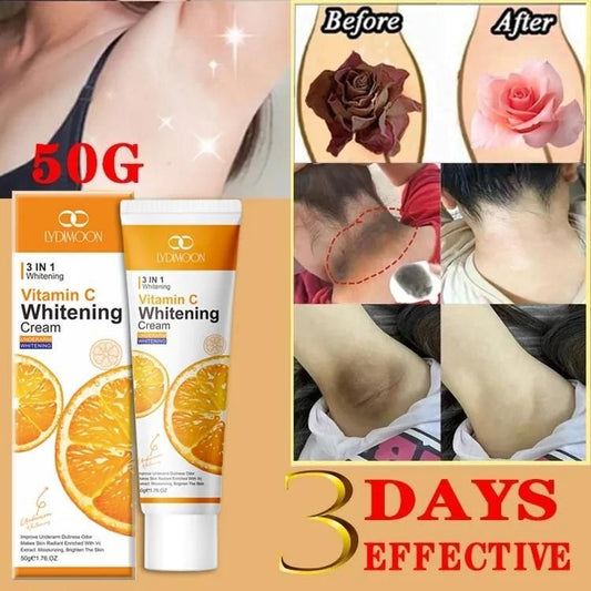 Vitamin C Whitening Cream 50g – Skin Brightening & Dark Spot Removal Crea