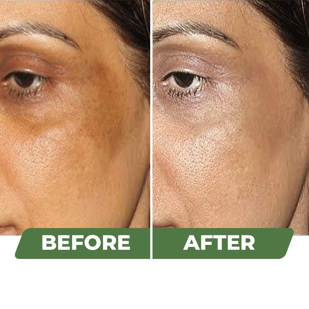 Organic Skin Brightening Cream (Pack of 2) – Hydrating & Glow Boosting Face Cream