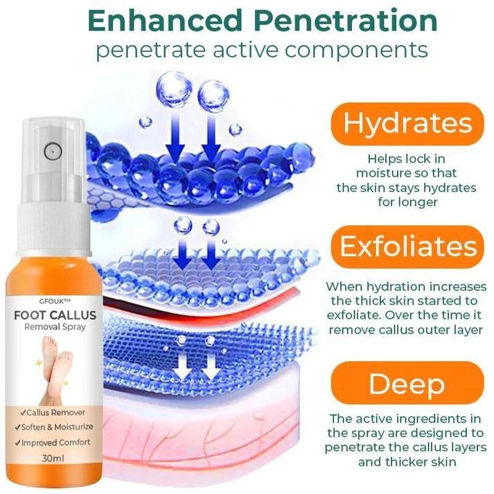 Foot Callus Removal Spray – Dead Skin Remover & Smooth Heel Care Spray