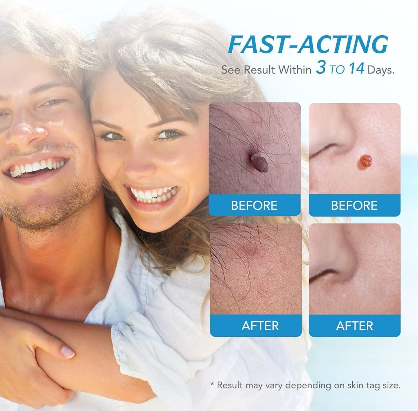 2-in-1 Skin Tag Remover Kit – Painless & Safe Skin Care Tool