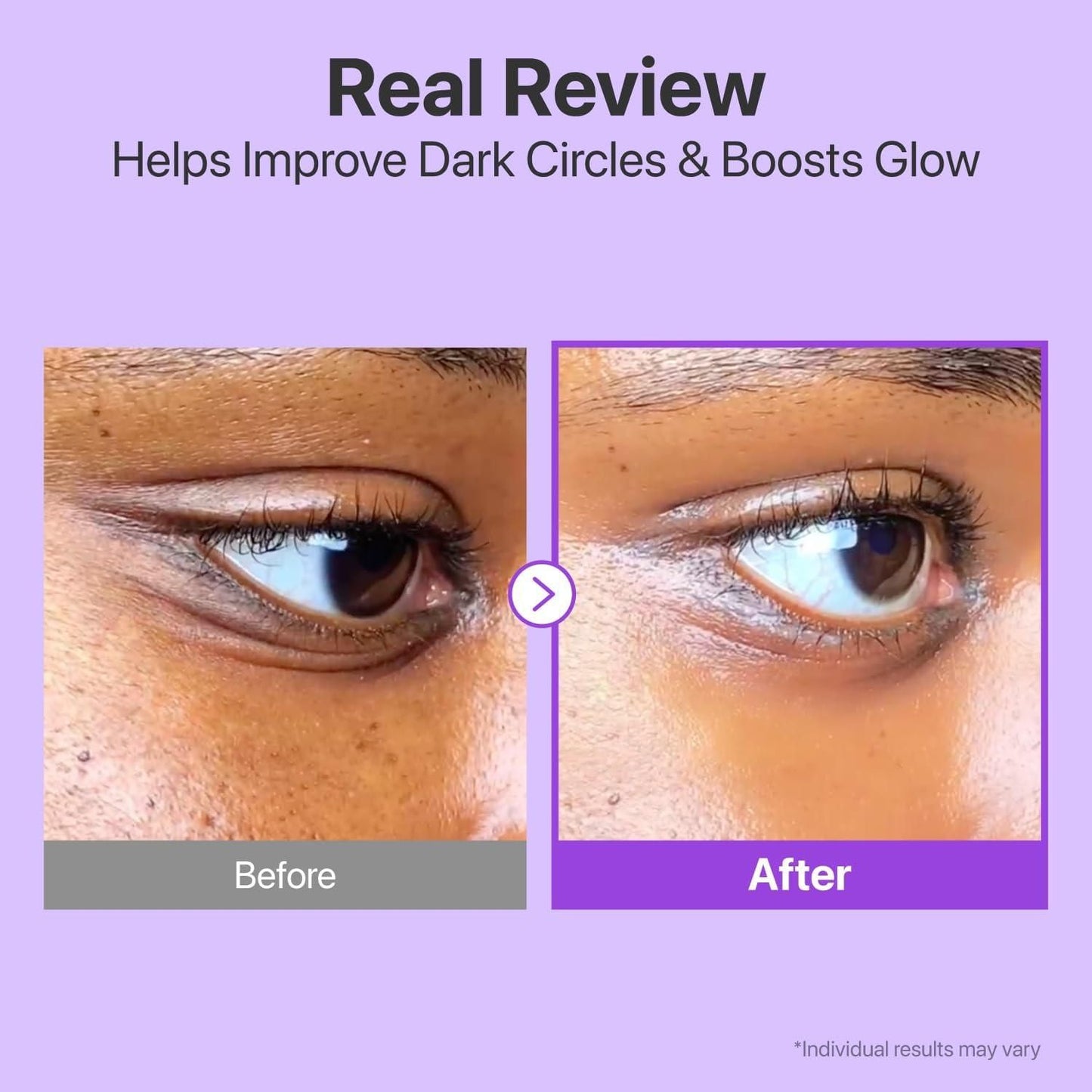 Volumetox Eye Cream 100gm – Dark Circles & Puffiness Remover | Under Eye Brightening