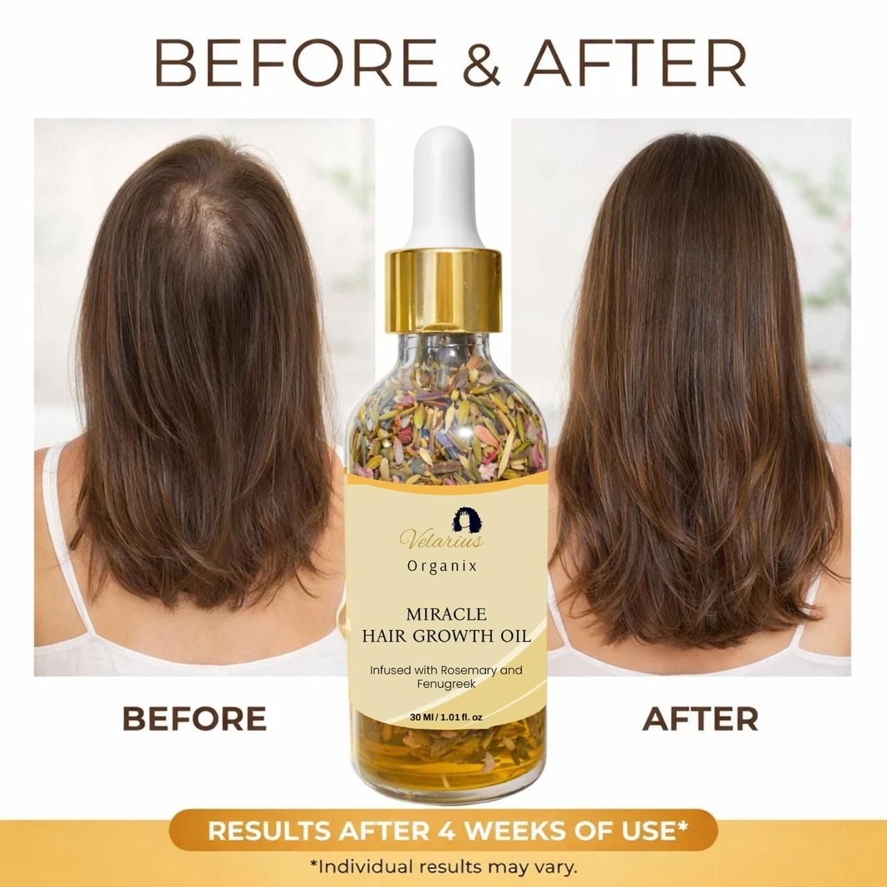 Miracle Hair Growth Oil 30ml – Anti Hair Fall & Hair Regrowth Oil with Rosemary & Fenugreek