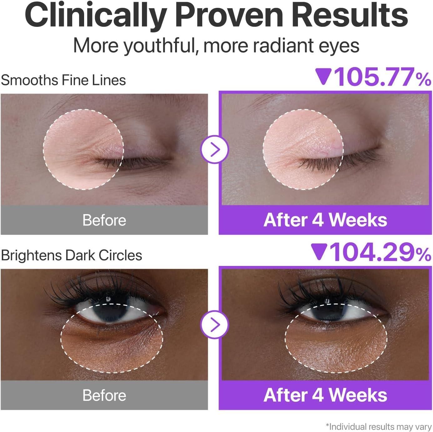 Volumetox Eye Cream 100gm – Dark Circles & Puffiness Remover | Under Eye Brightening